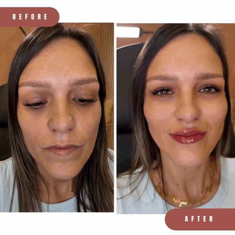563461815_17973978296940847_5460585051294443539_n