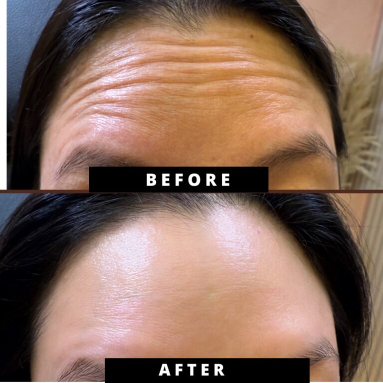 Simple Photocentric Before and After Instagram Post - 1