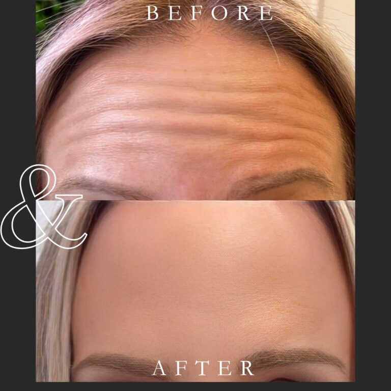 Black and White Lash Tech Before and After Instagram Post - 1